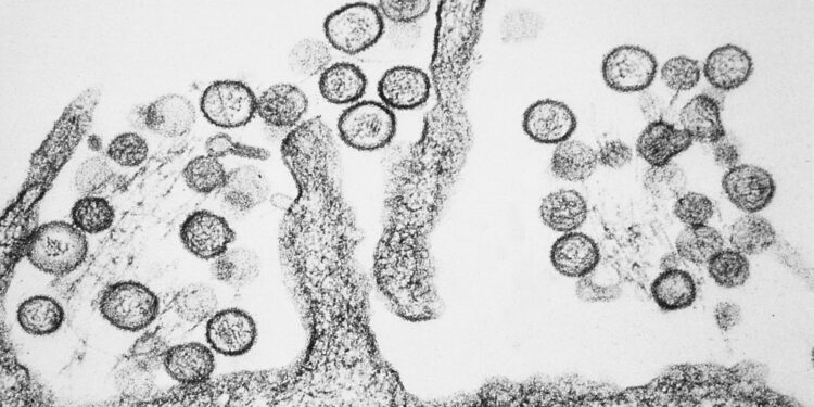 Novo risco de pandemia? Saiba sobre vírus que deixou a OMS em alerta após surto em Cruzeiro