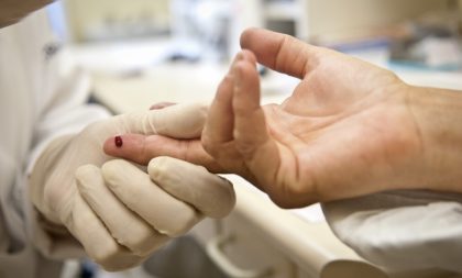 Pesquisadores anunciam segundo caso mundial de remissão do vírus da Aids