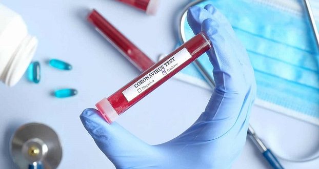 Prefeitura investe R$ 144 mil na compra testes para coronavírus
