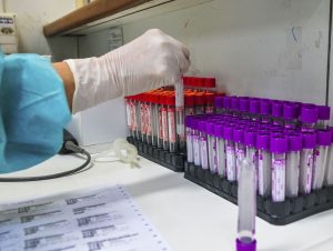 Estudo brasileiro: corticoide reduz gravidade de efeitos da Covid-19