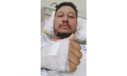 Motoboy fica gravemente ferido após carro bater e fugir