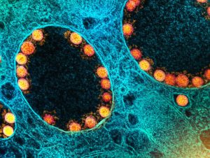França identifica nova variante do Coronavírus com mais de 40 mutações