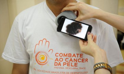 Guia procura esclarecer relação entre Covid-19 e lesões de pele