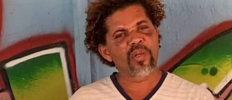 Morador de rua espancado por personal é convidado para virar candidato