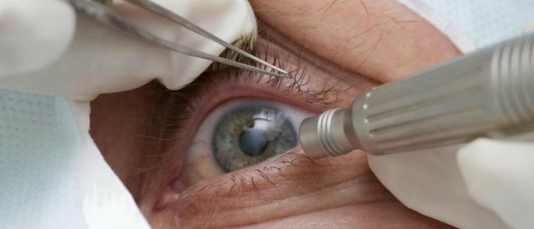 Pandemia x Glaucoma: entenda os efeitos que dificultam diagnóstico