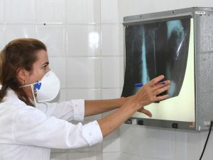 Governo cria comitê para reduzir casos de tuberculose até 2030