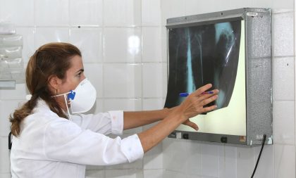 Governo cria comitê para reduzir casos de tuberculose até 2030