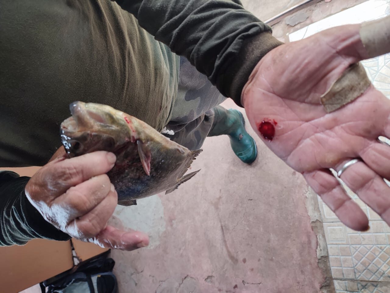 Ataque de piranha no Rio Jacuí deixou pescador ferido em Cachoeira do Sul / Fotos: Divulgação