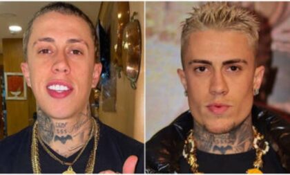 MC Daniel: antes e depois da harmonização