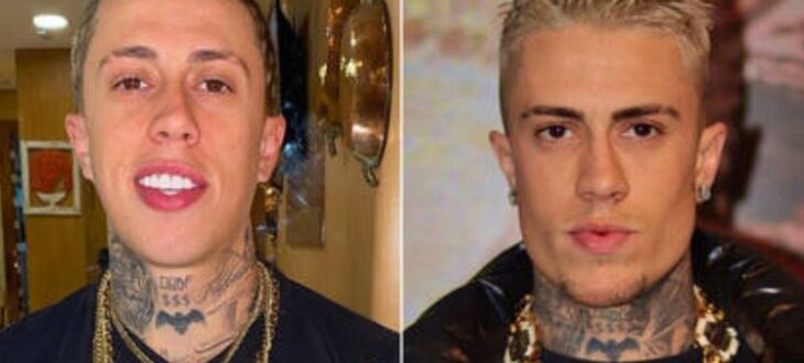 MC Daniel: antes e depois da harmonização