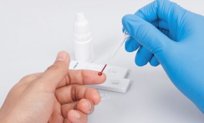Saúde adota testagem para idosos com suspeita de dengue