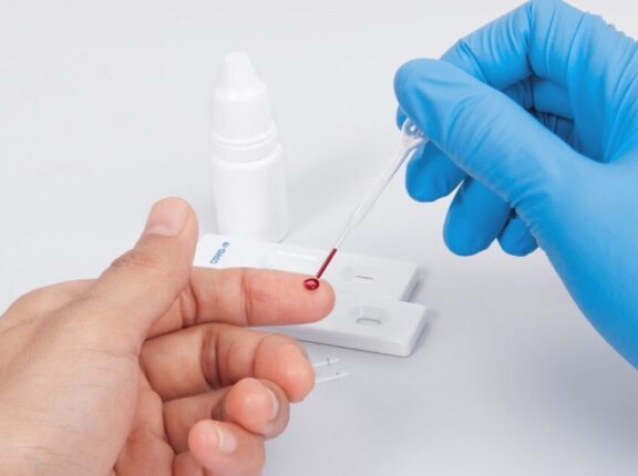 Saúde adota testagem para idosos com suspeita de dengue